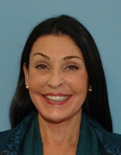 Complete Refreshed Makeovers Before & After Gallery - Patient 977212 - Image 2