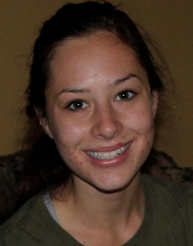 Hydrafacial Before & After Gallery - Patient 117119 - Image 1