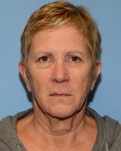 neck lift patient