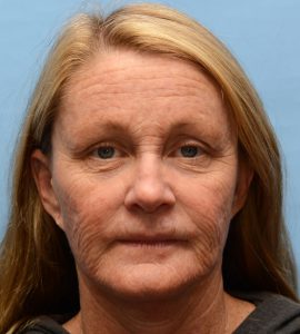 female patient