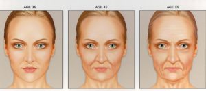 sculptra patient infographic