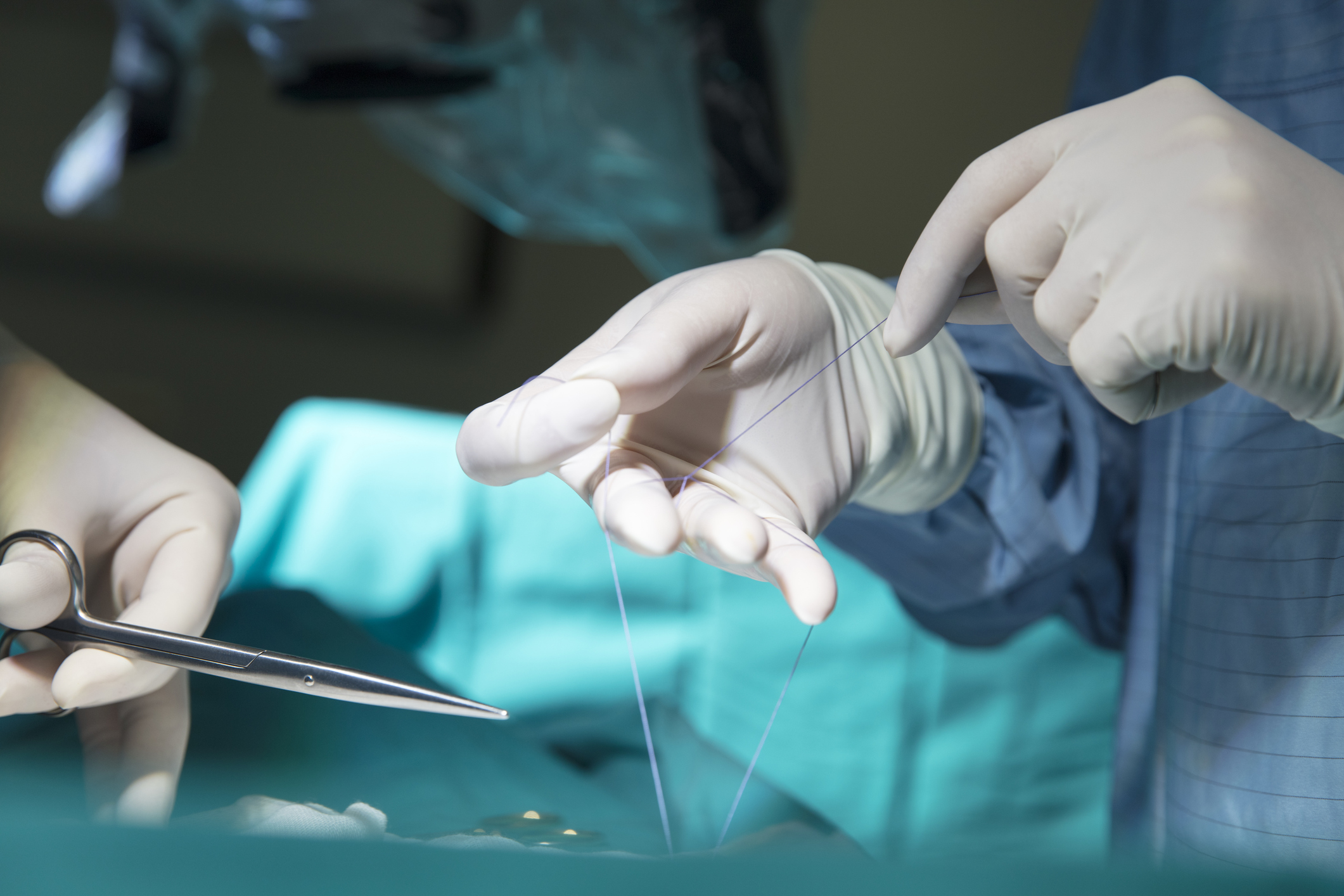 Dissolving Stitches