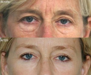 patient results