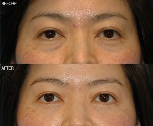 patient results