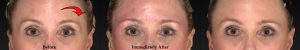 images of a females eyebrows