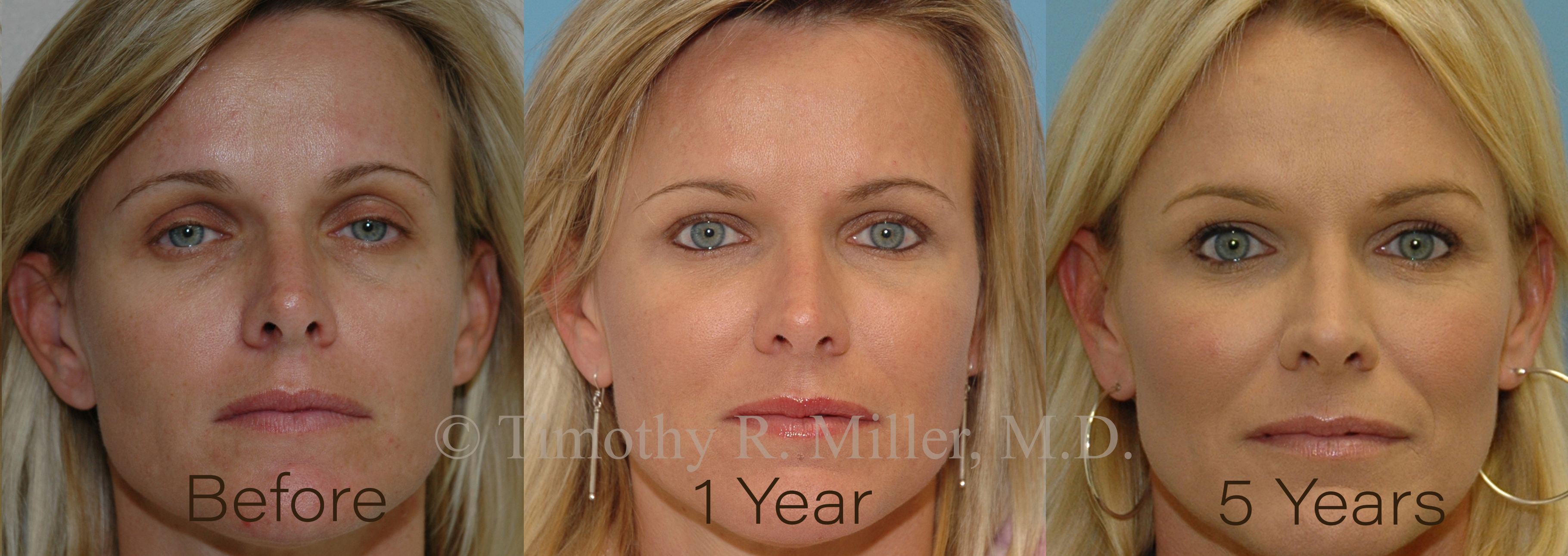 Plastic Surgery Orange County