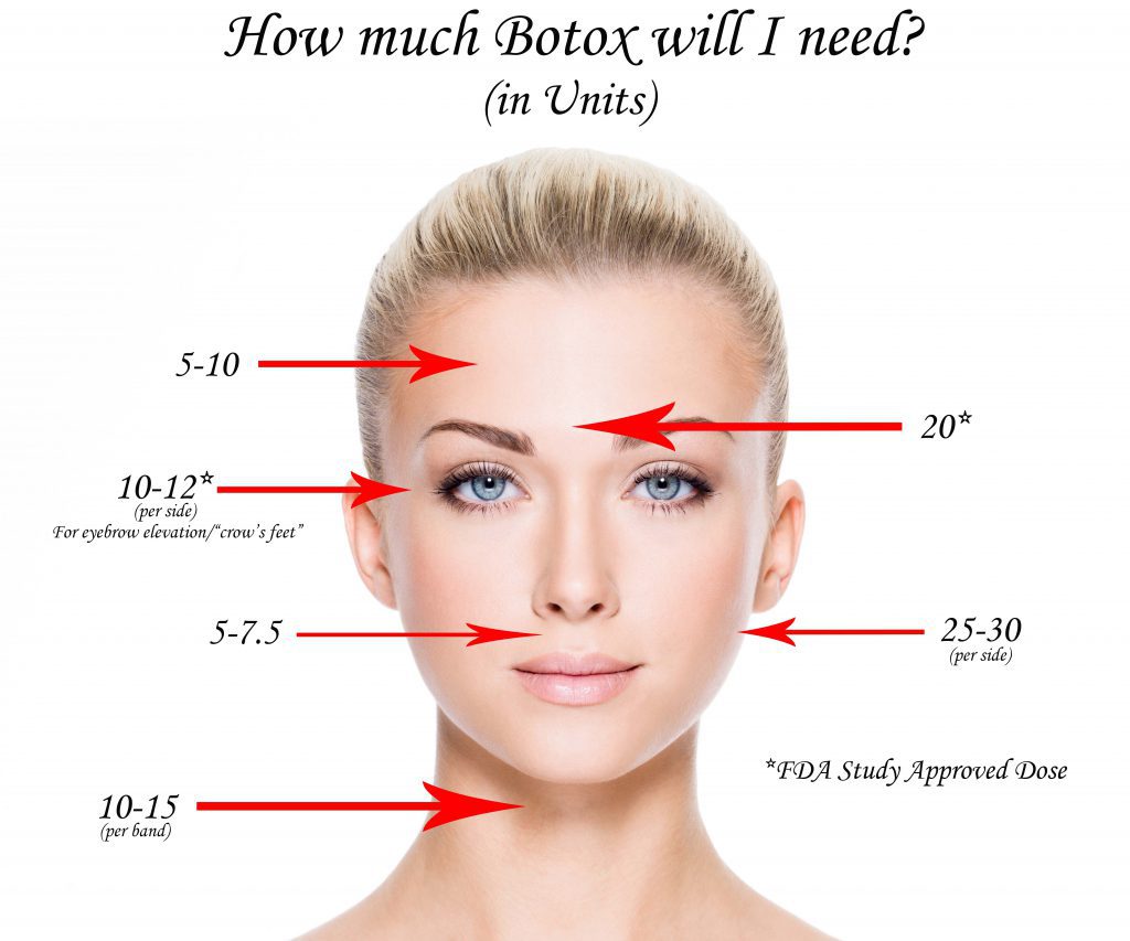 Amount of BOTOX needed
