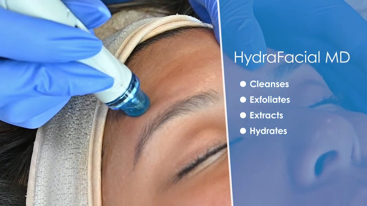 hydrafacial treatment