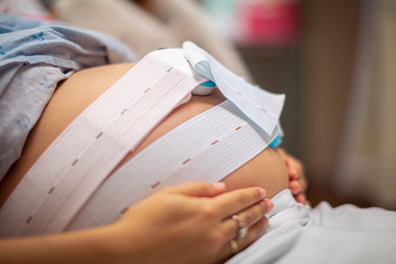 Pregnant woman wearing a fetal monitoring belt during labor to track the baby's heart rate and monitor for signs of distress.