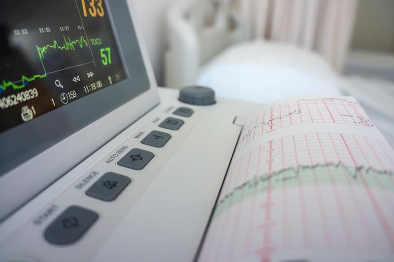 Fetal heart monitor displaying a baby's heart rate and printed monitoring strip during labor in a hospital.