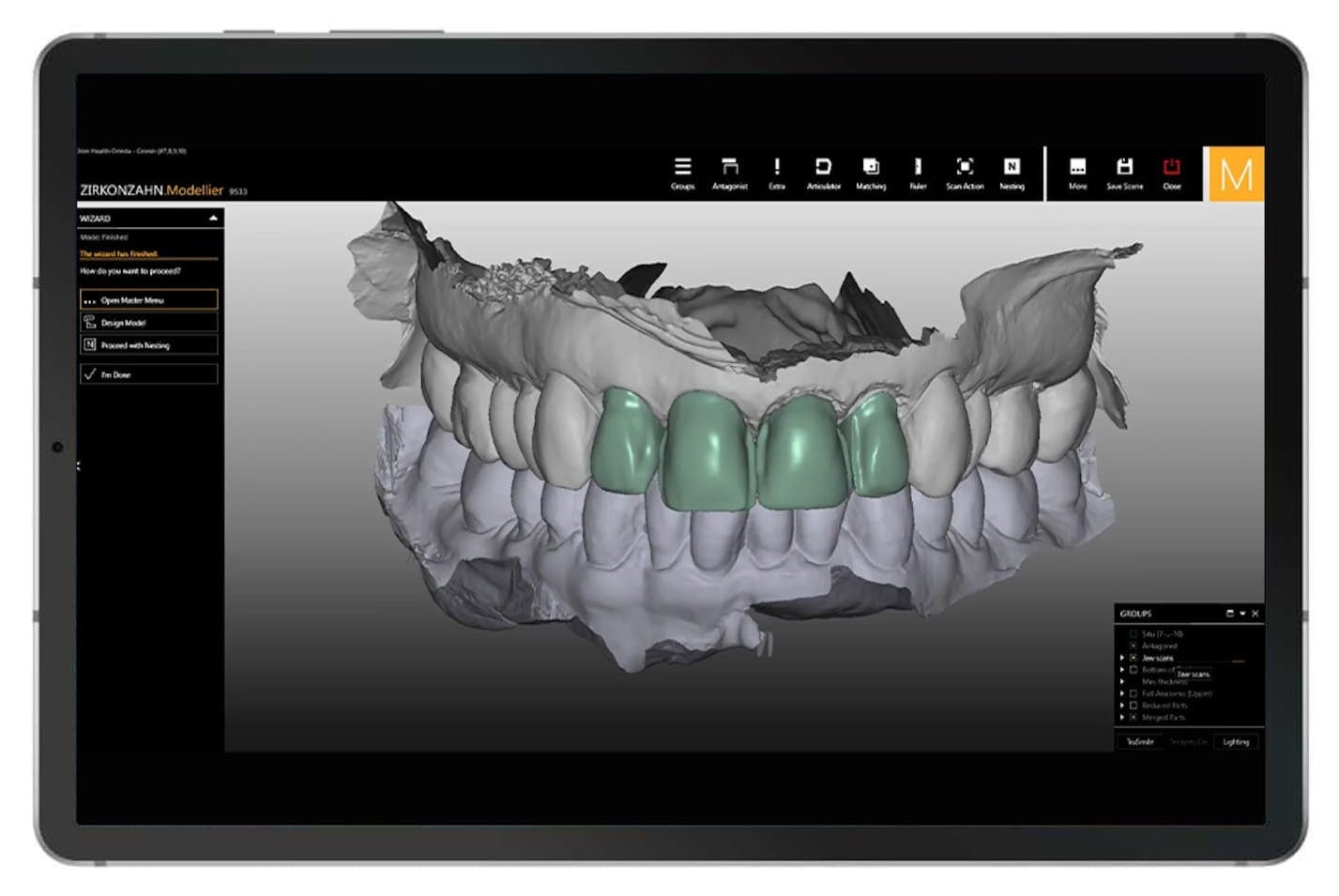imaging of a jaw and new teeth