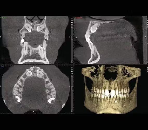 x-ray imaging of a jaw