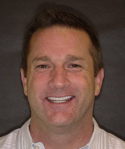 Anti Aging Before & After Gallery - Patient 275757 - Image 2