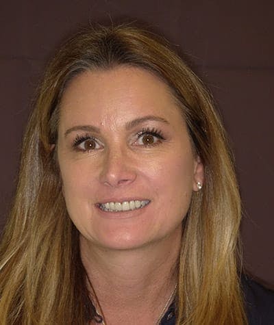 Anti Aging Before & After Gallery - Patient 382197 - Image 1