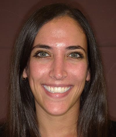 Anti Aging Before & After Gallery - Patient 128965 - Image 2