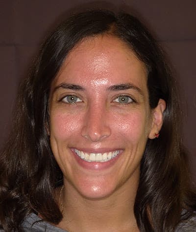 Anti Aging Before & After Gallery - Patient 128965 - Image 1