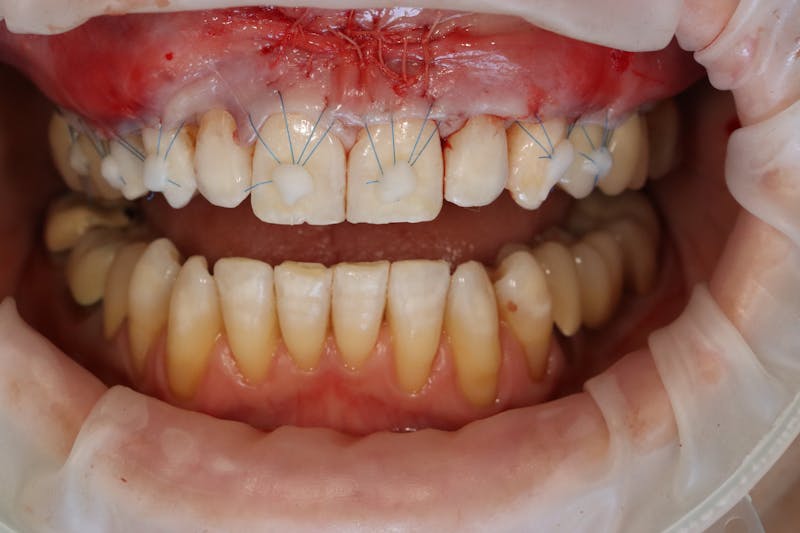 Other Procedures Before & After Gallery - Patient 297121 - Image 10