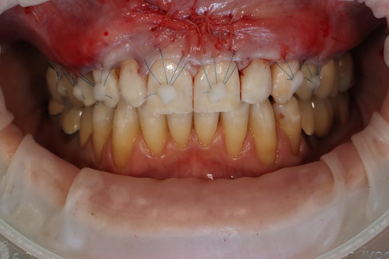 Other Procedures Before & After Gallery - Patient 297121 - Image 12