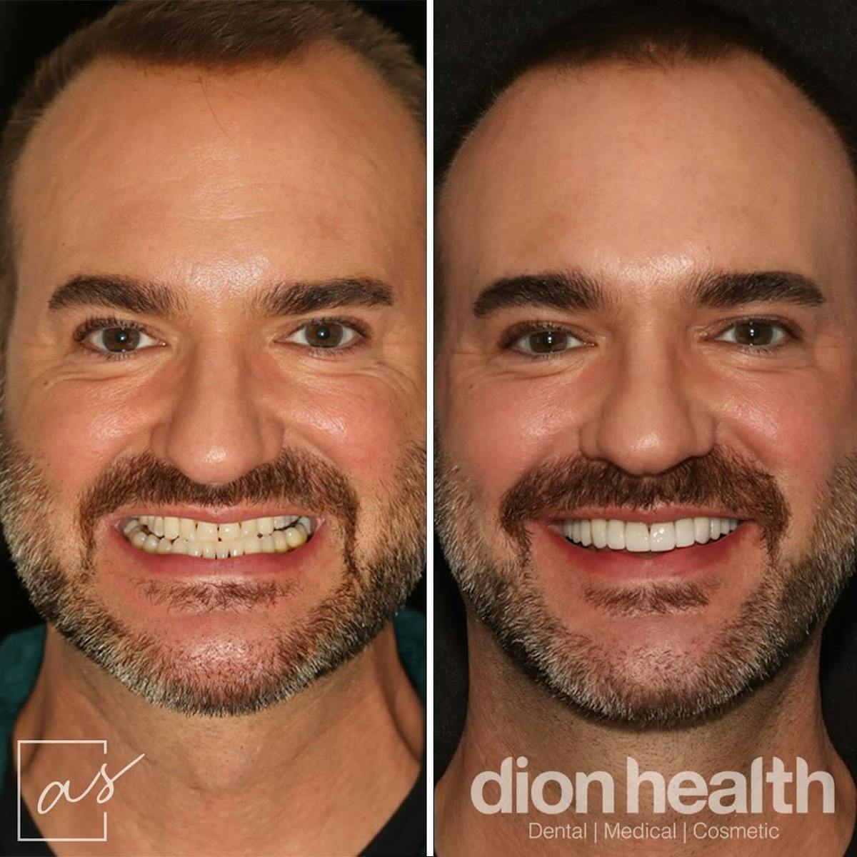 Anti Aging Before & After Gallery - Patient 412401 - Image 1