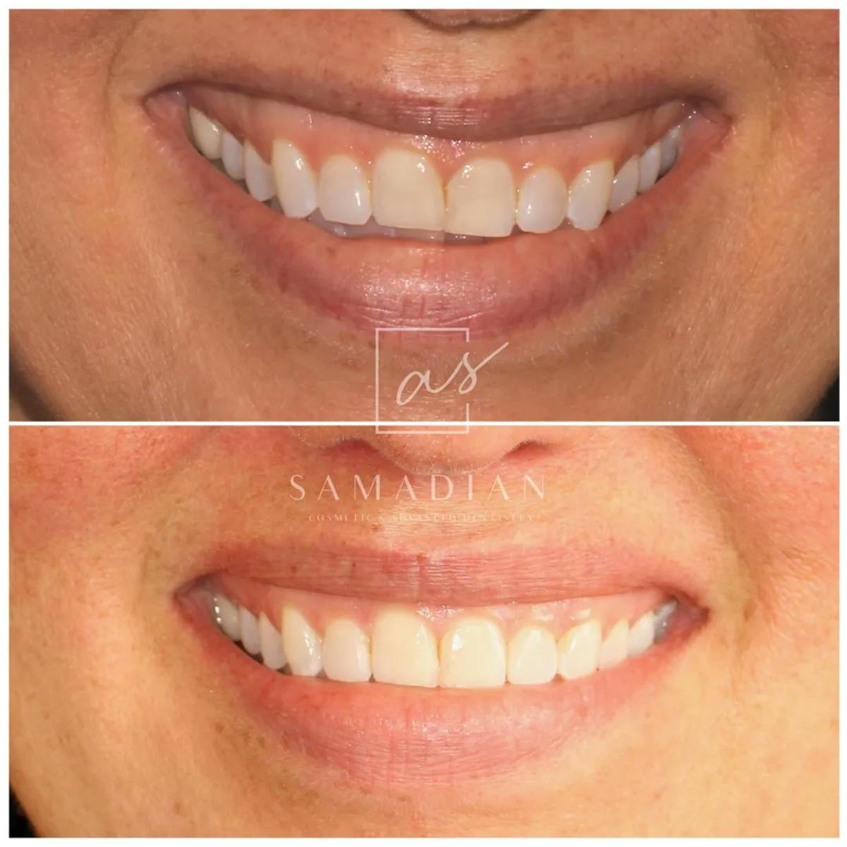 Other Procedures Before & After Gallery - Patient 251127 - Image 1