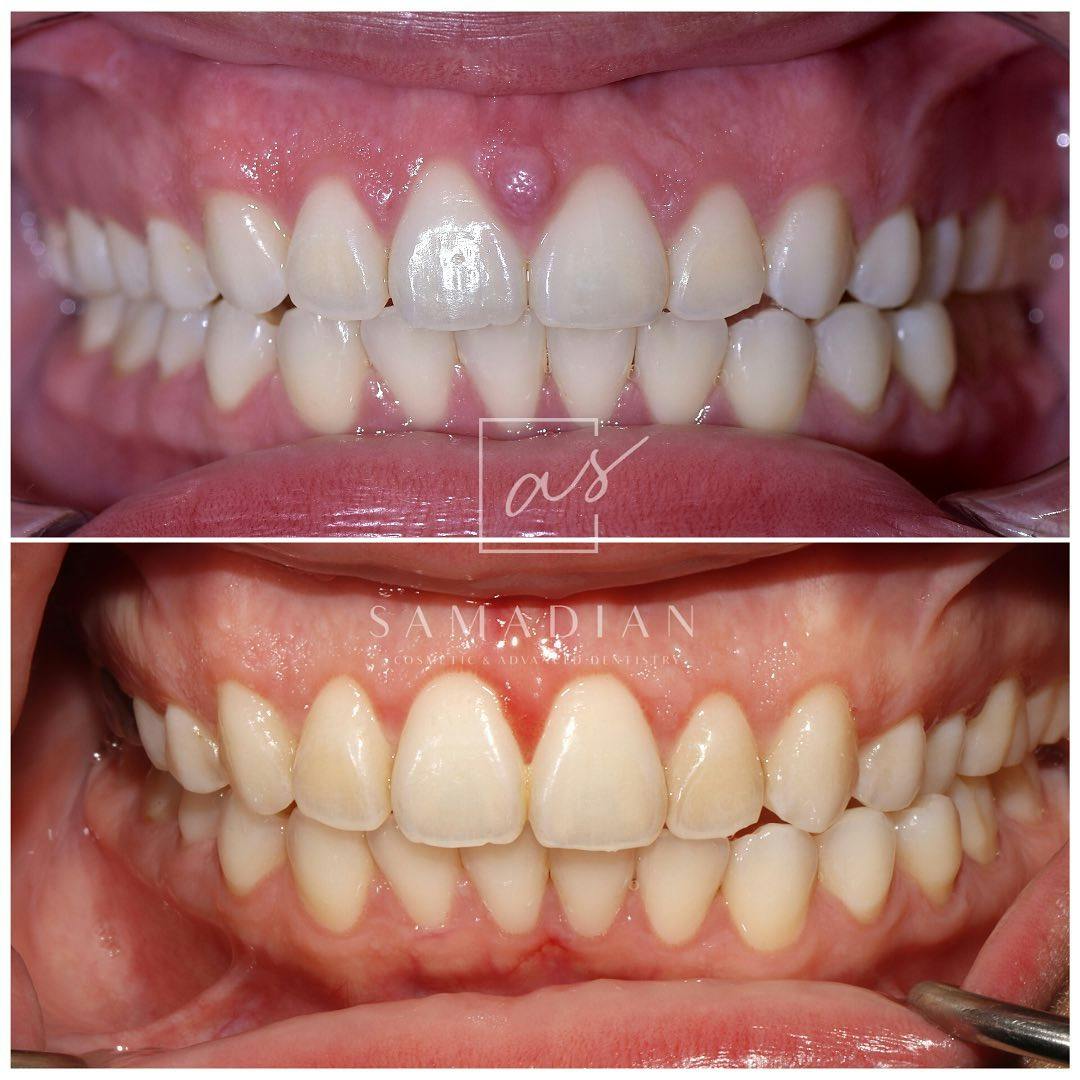 Other Procedures Before & After Gallery - Patient 272967 - Image 2