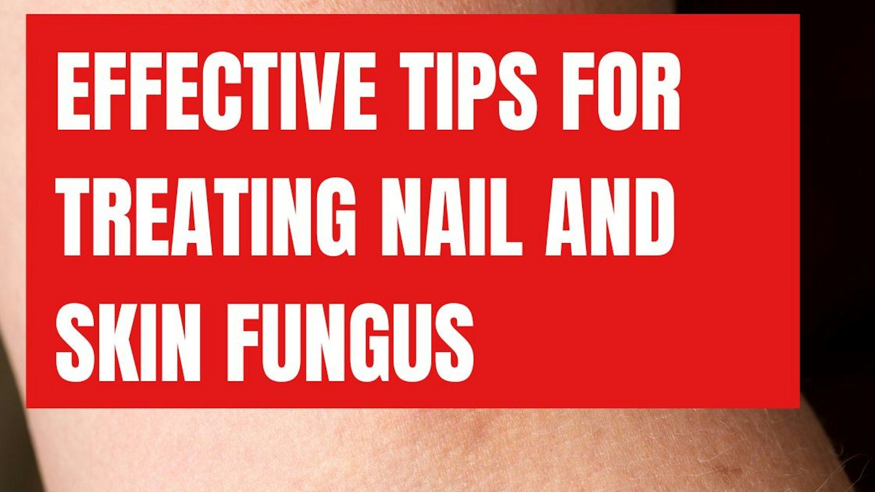 Cover Image for Effective Tips for Treating Nail and Skin Fungus: Why NanoDefense Pro is the Best Solution
