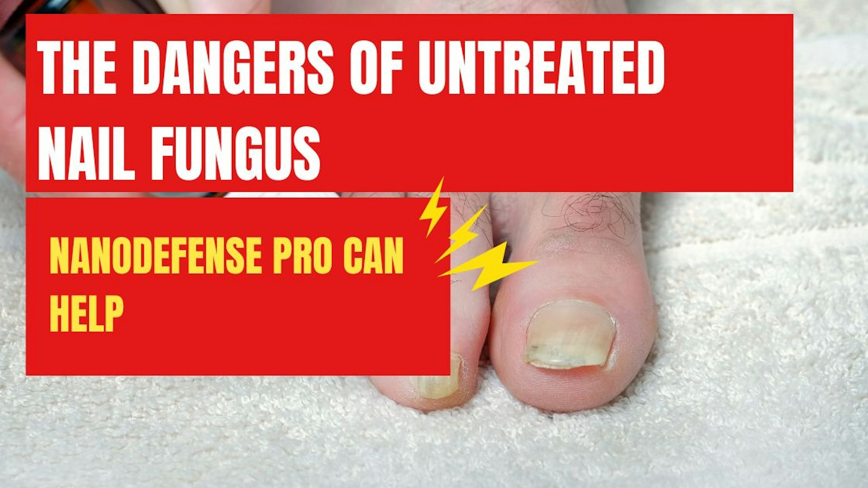 Cover Image for The Dangers of Untreated Nail Fungus and How NanoDefense Pro Can Help