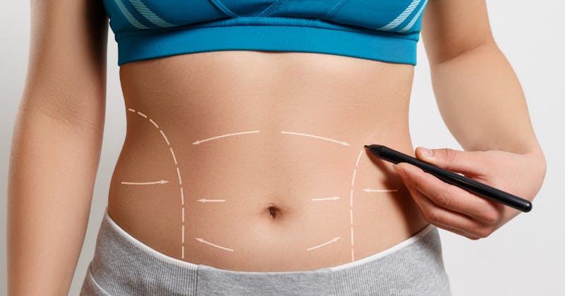 Which Tummy Tuck Is Right for You? | Portland Plastic Surgery Group