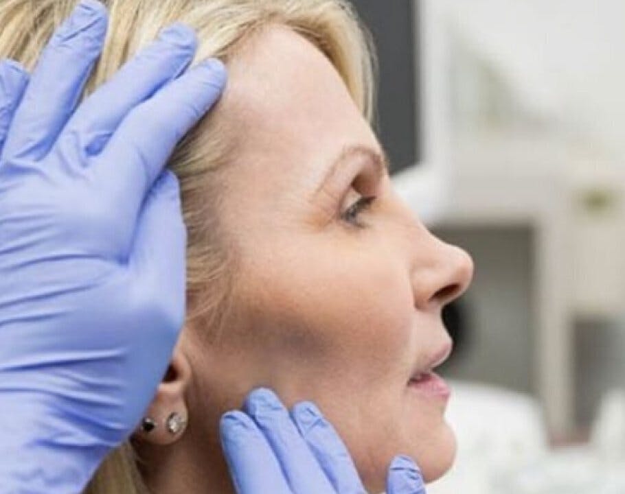 Tomorrow Filler Options Are Here