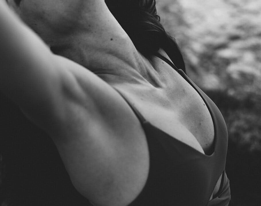 How to Minimize Breast-Augmentation Scars