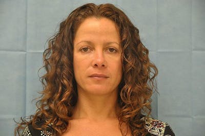 BOTOX Before & After Gallery - Patient 136623 - Image 1