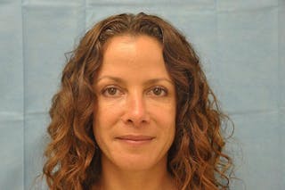 BOTOX Before & After Gallery - Patient 136623 - Image 2