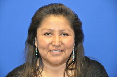 Lower Blepharoplasty Before & After Gallery - Patient 612458 - Image 2