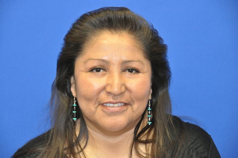 Lower Blepharoplasty Before & After Gallery - Patient 612458 - Image 2
