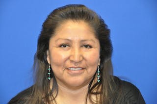 Lower Blepharoplasty Before & After Gallery - Patient 612458 - Image 2