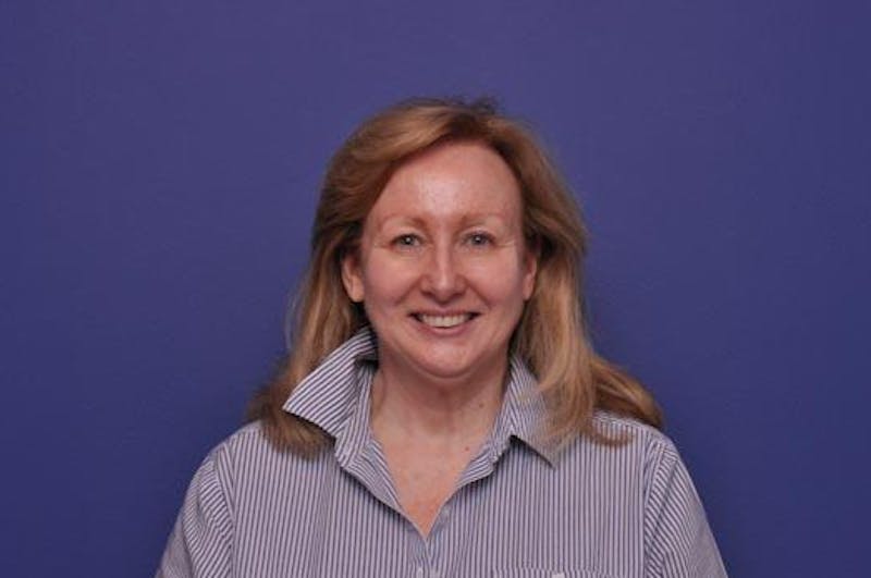 Lower Blepharoplasty Before & After Gallery - Patient 461964 - Image 1