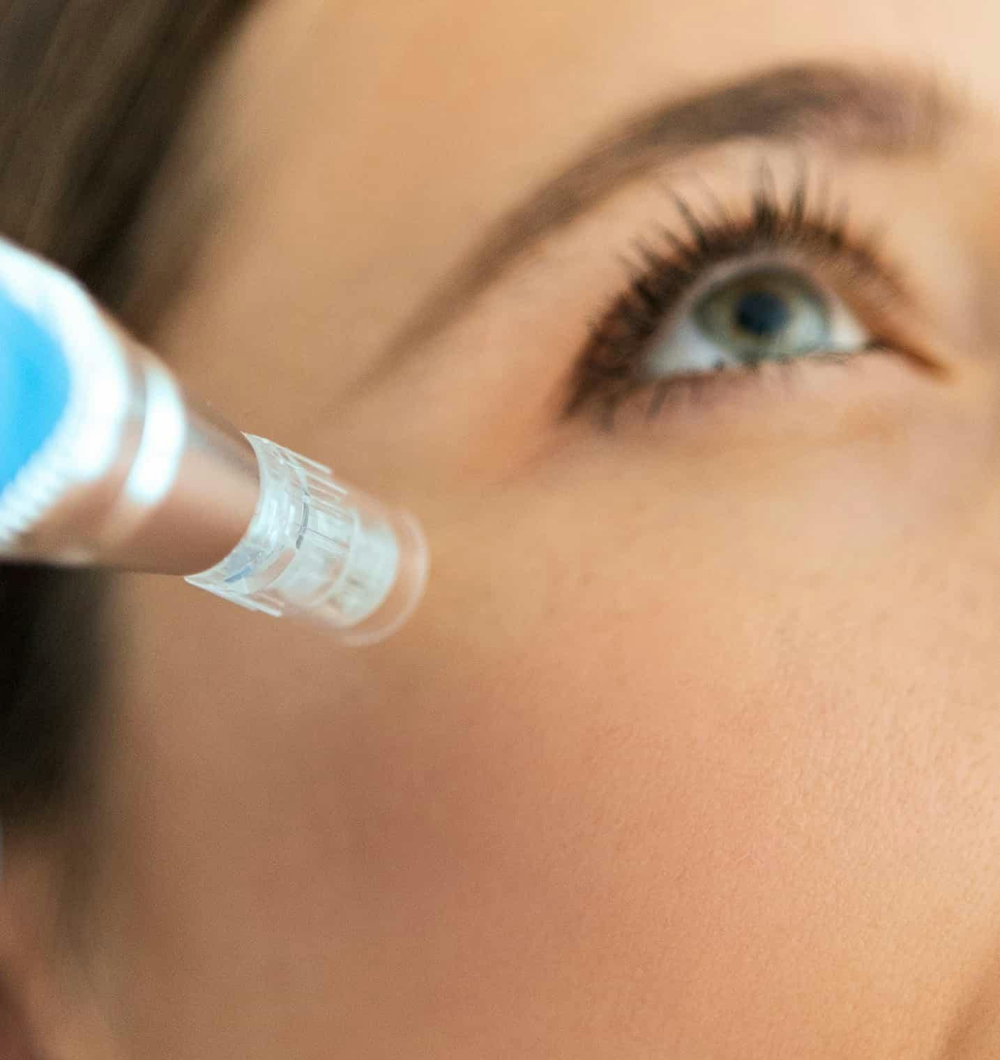 Woman receiving microneedling treatment