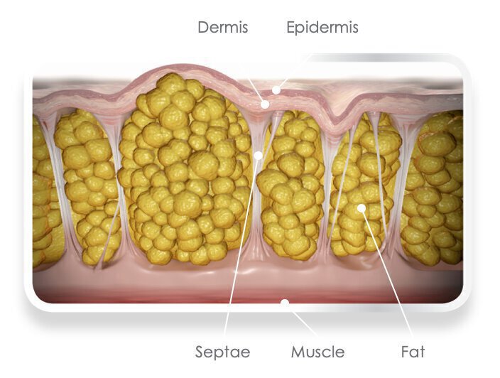dermis and epidermis illustration