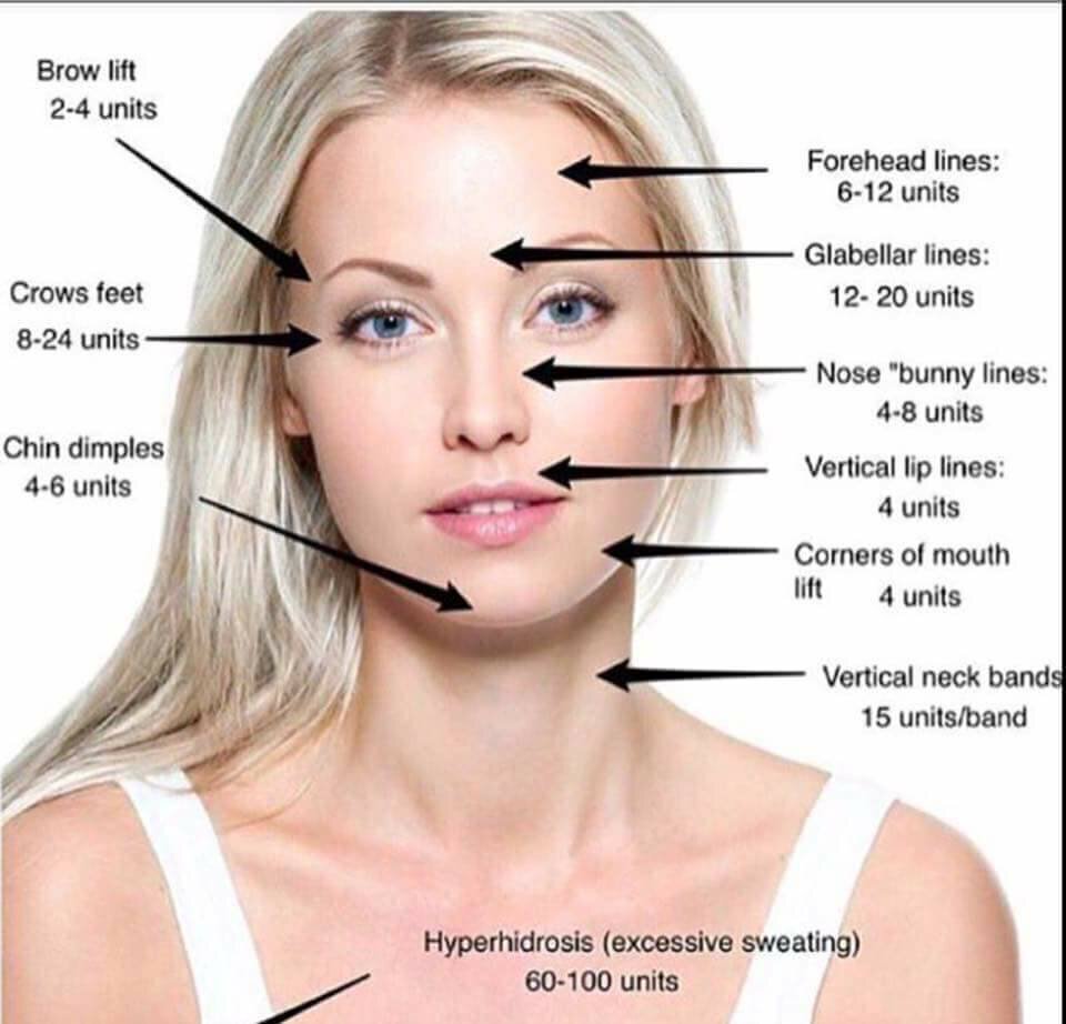 botox infographic