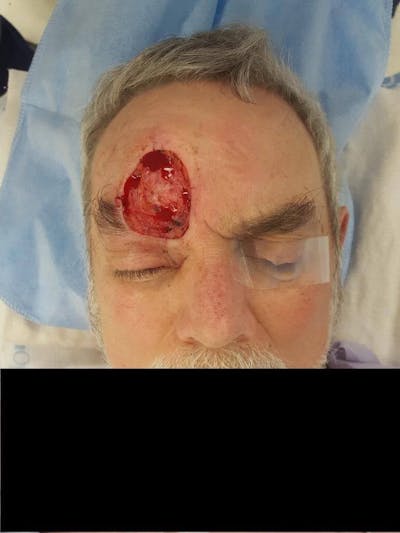 Facial Reconstruction Before & After Gallery - Patient 361297 - Image 1