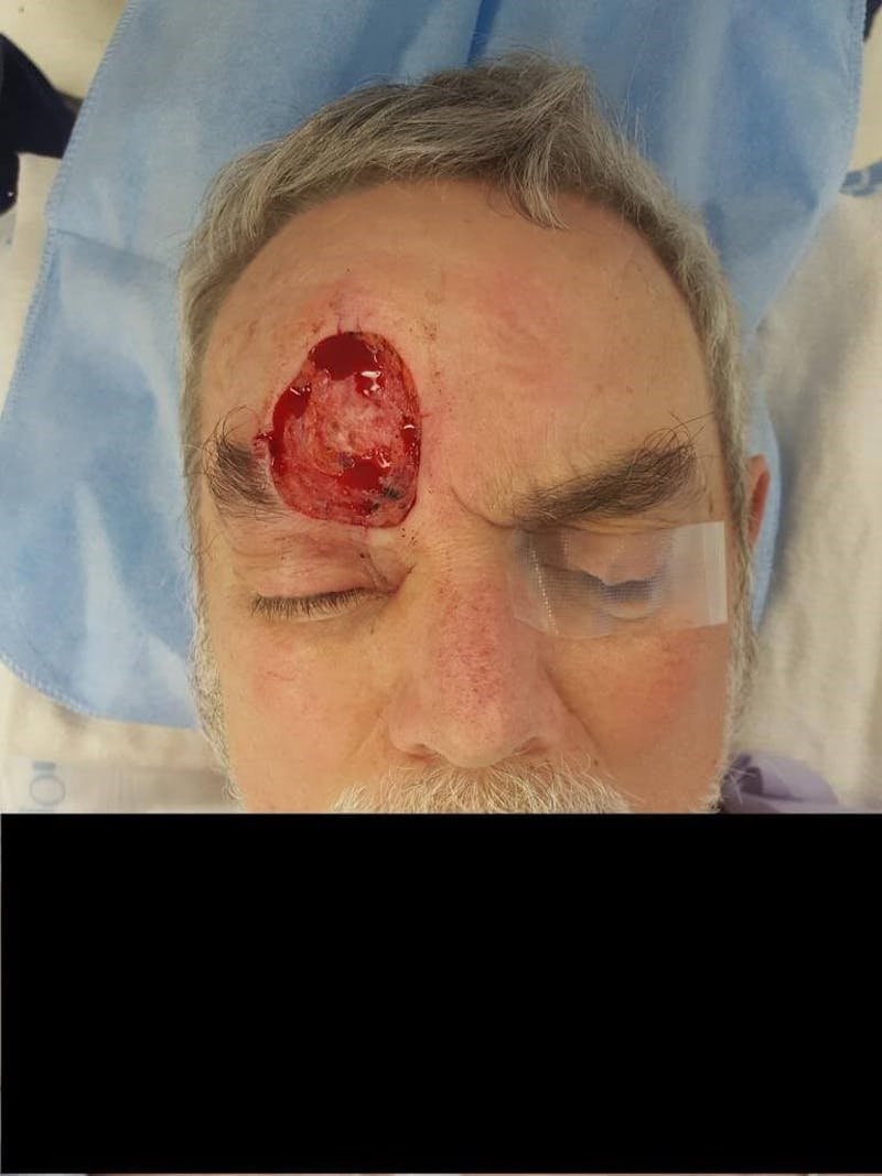 Facial Reconstruction Before & After Gallery - Patient 361297 - Image 1