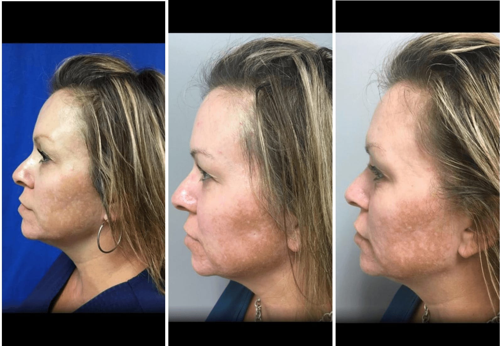 patient results