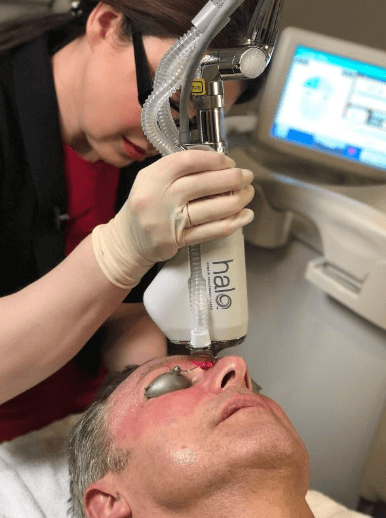 person undergoing a halo laser procedure