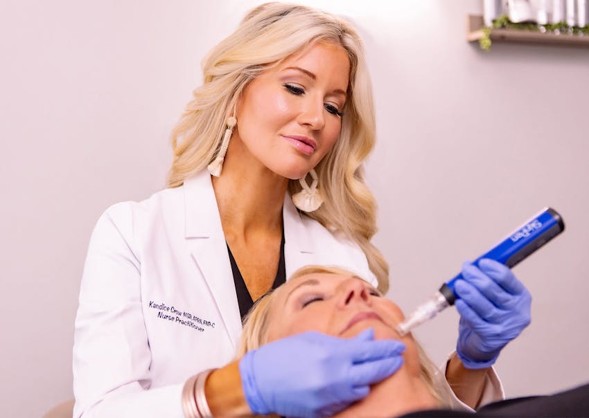 Kandice administering microneedling
