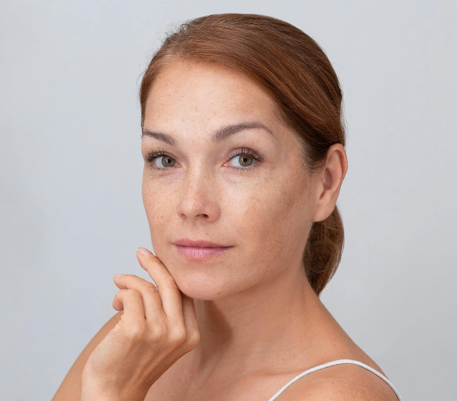 Freckled woman smiling