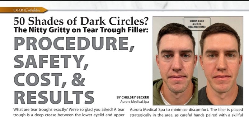 Facial fillers banner