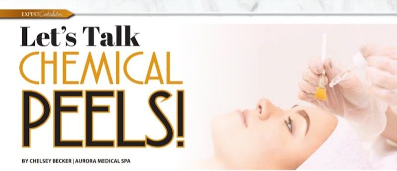 Chemical peels banner