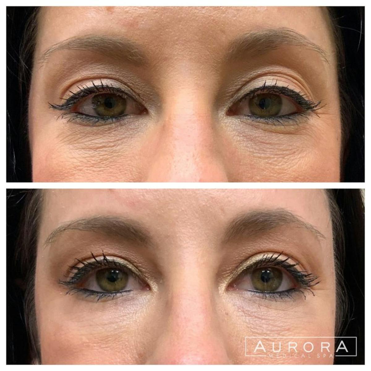 Facial Balancing Before & After Gallery - Patient 257568 - Image 1