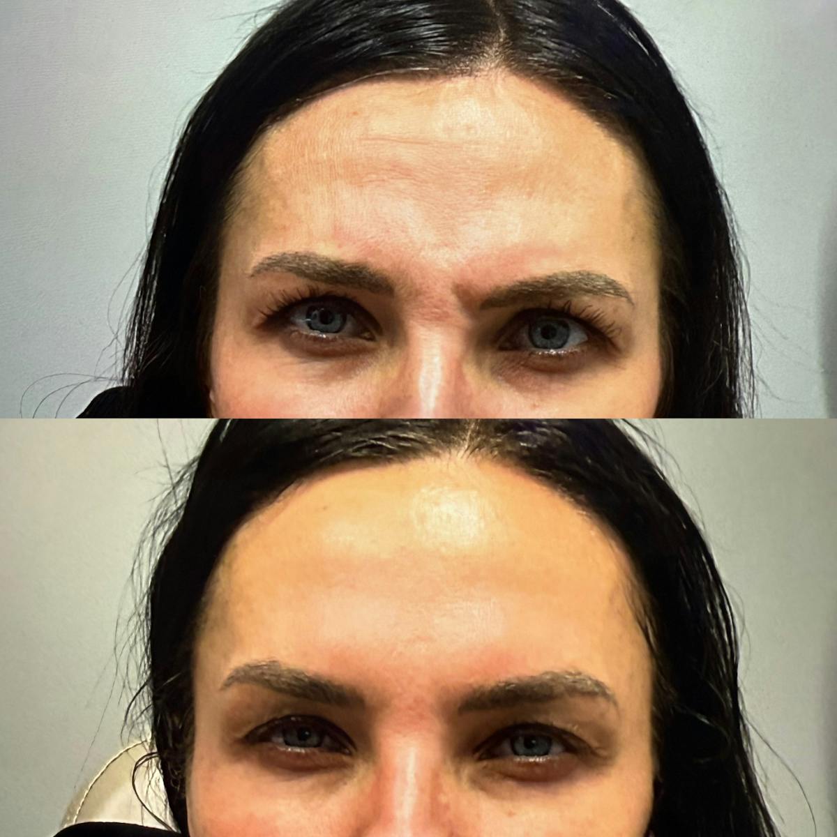 DAXXIFY Before & After Gallery - Patient 519173 - Image 2