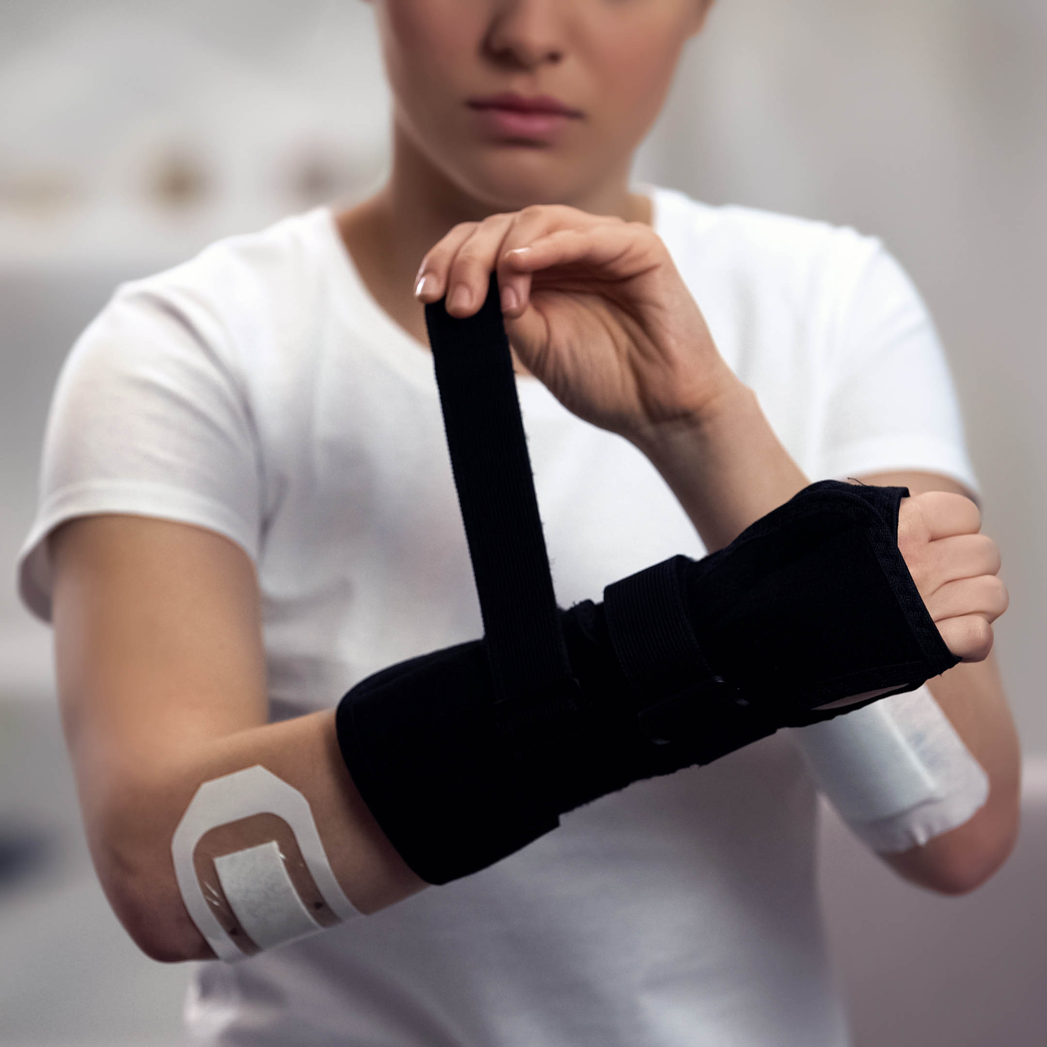 Alles wat je moet weten over braces.